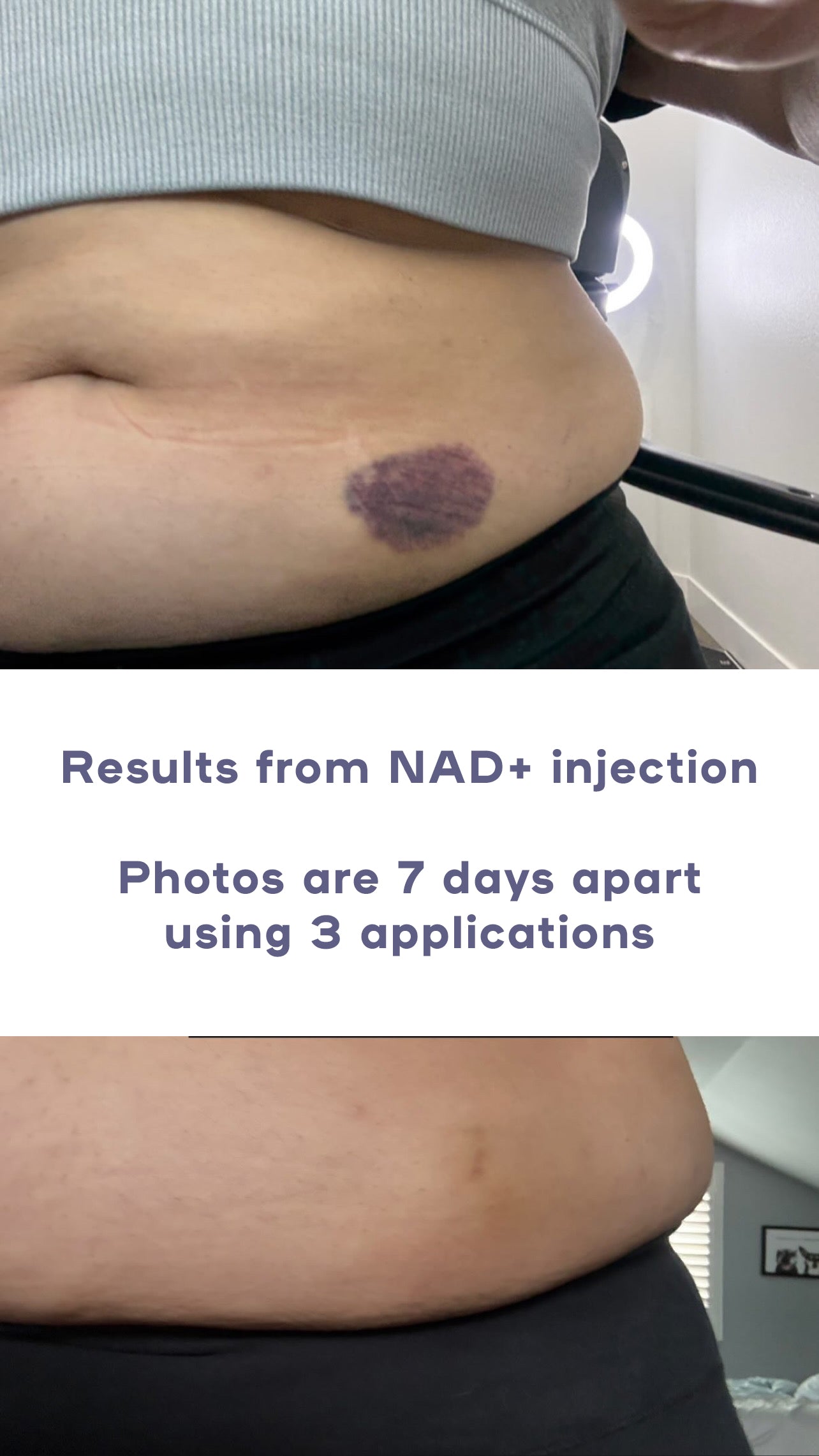 Hydroslime™ Lip Masks